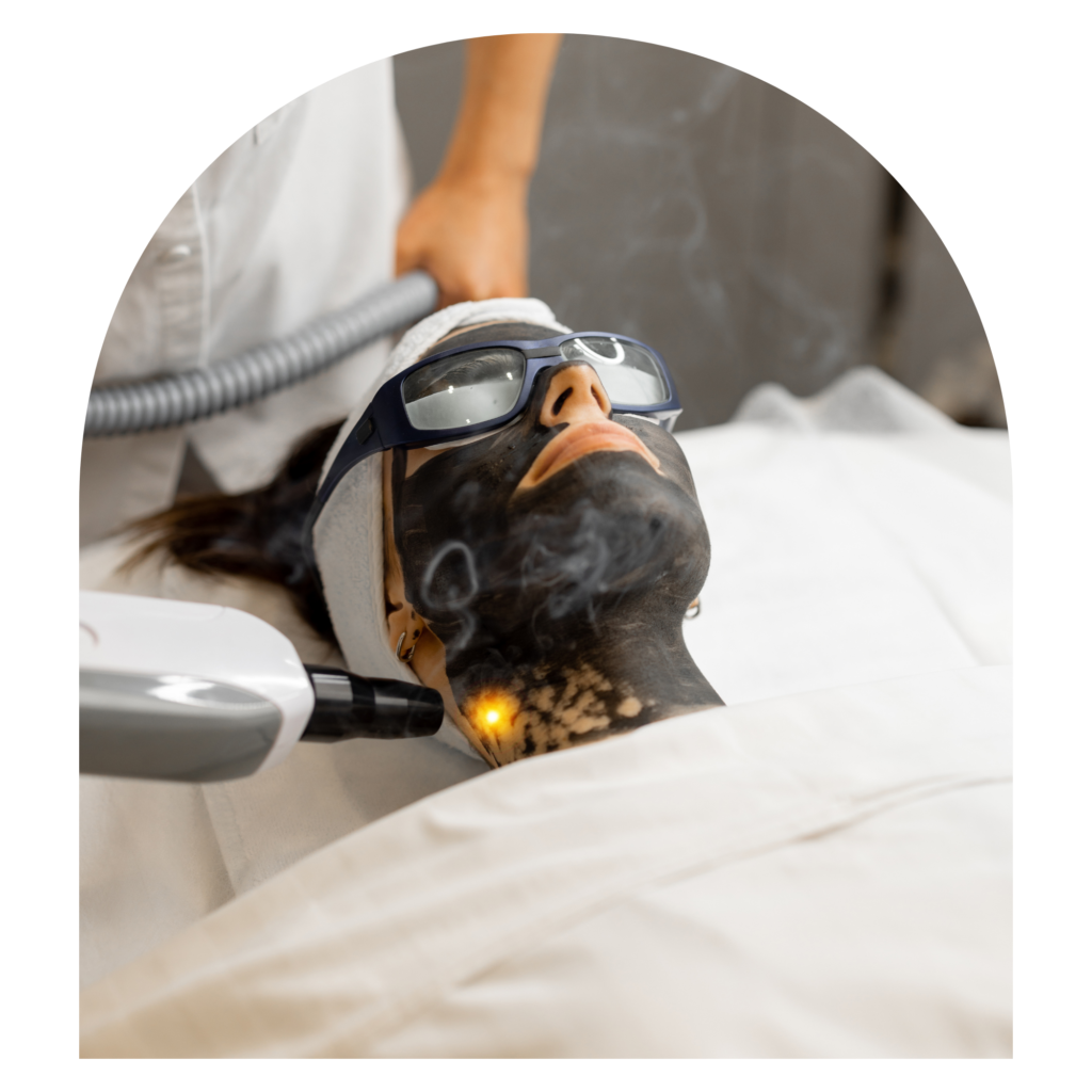 Carbon peeling Berlin